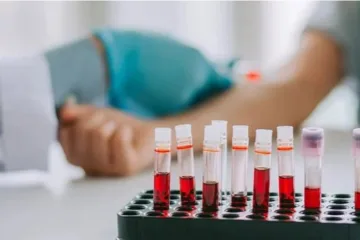 پرولاکتین
