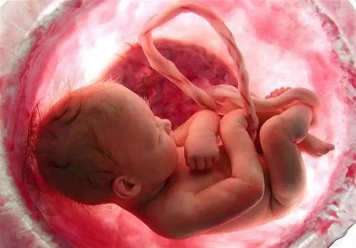 Abortion-1