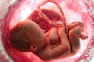 Abortion-1